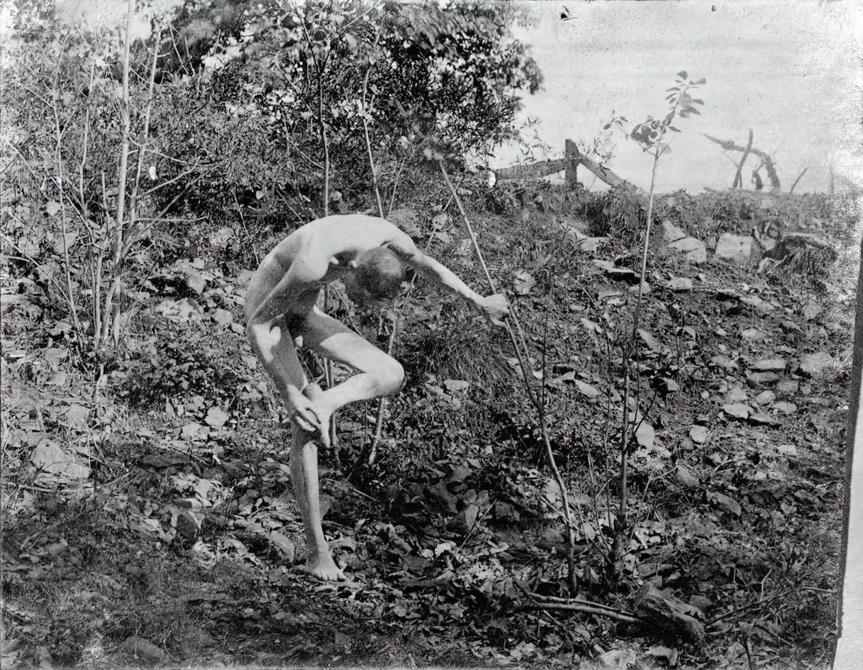 Extrator de Espinho, c. 1883. de Thomas Eakins