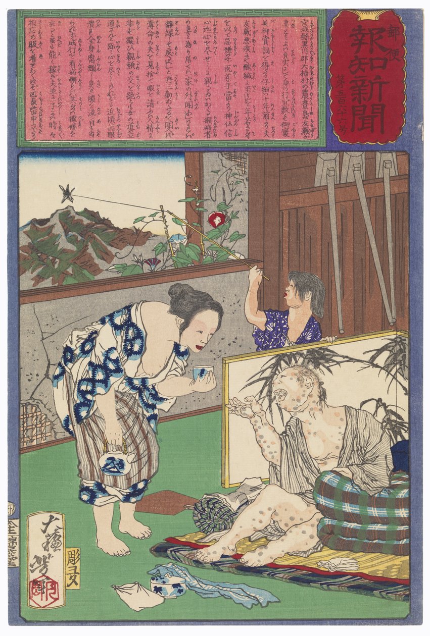 Toshima Tomiyo que ficou com o seu marido leproso, Tomozō de Tsukioka Yoshitoshi