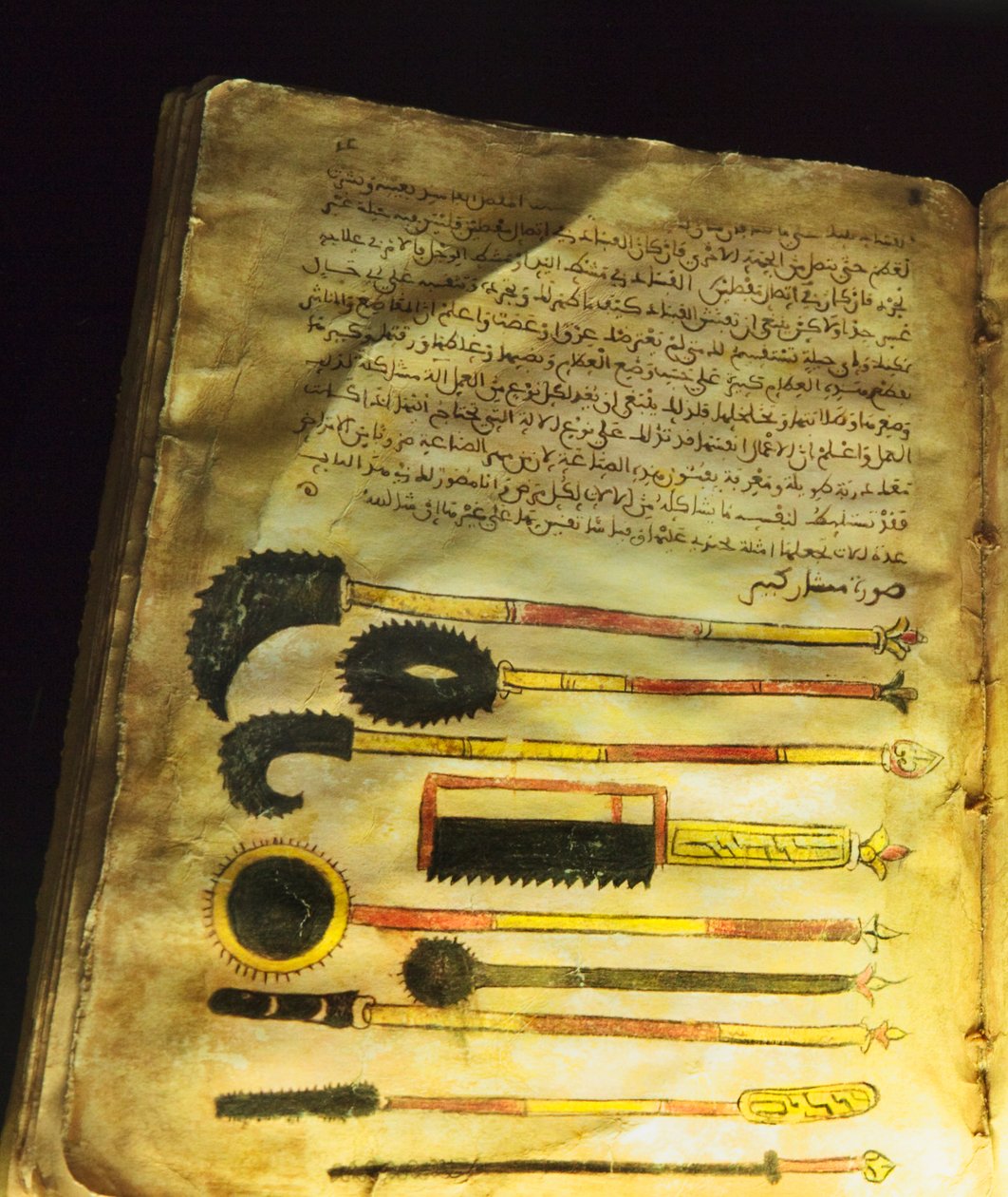 Ilustração de &39;On Surgery and Instruments&39; ou &39;Al-Zahrawi&39;, de Abu al-Qasim al-Zahrawi de Unbekannt Unbekannt