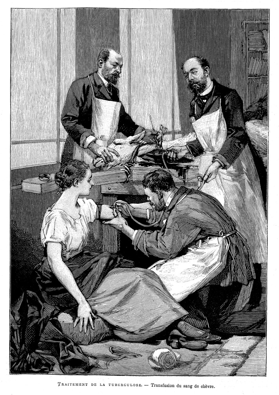 Paciente com tuberculose recebendo transfusão de sangue de cabra, 1891 de Unbekannt