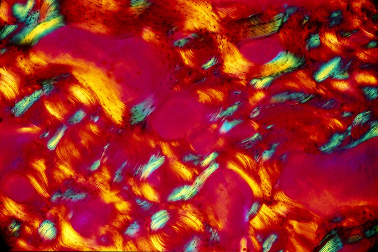 BIO-MATERIAIS, LM Bone de Unbekannt