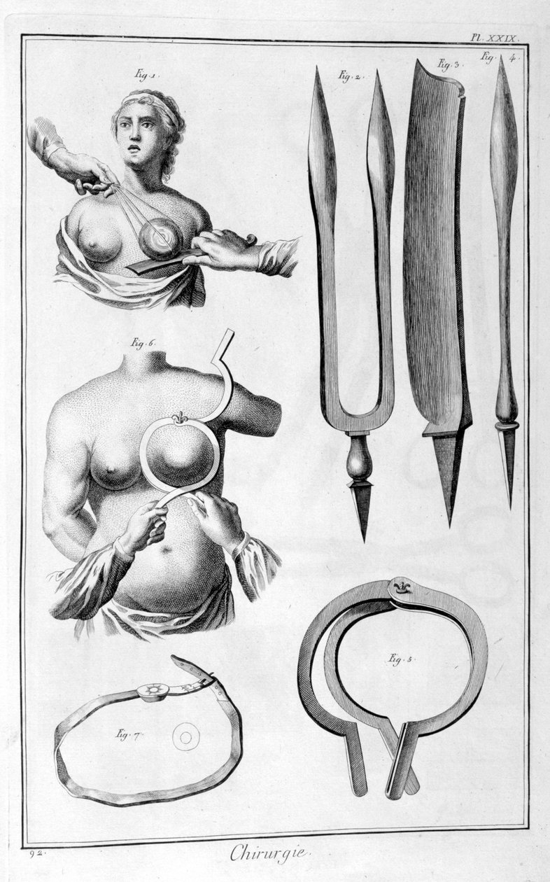 Cirurgia de mama, 1751-1777 de Unbekannt