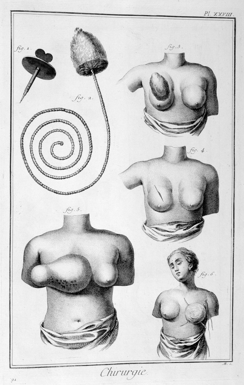 Cirurgia da mama, 1751-1777 de Unbekannt