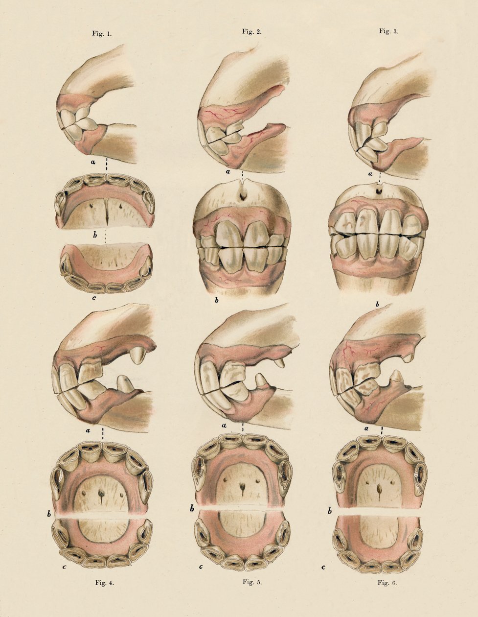 Descrição da placa mostrando a idade, conforme indicado pelos dentes, c1879. de Unbekannt