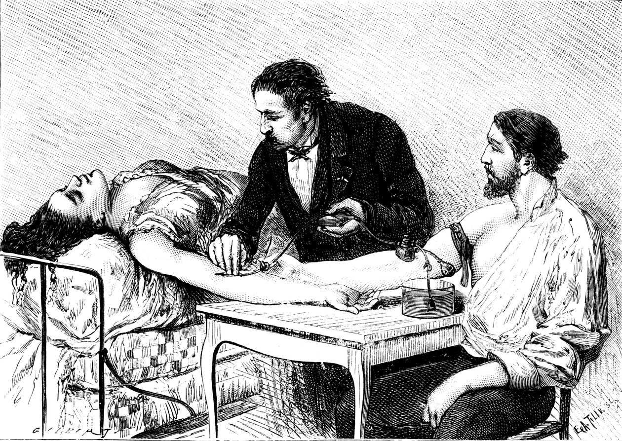 Dr. Roussell, de Genebra, dando a uma mulher uma transfusão direta de sangue de um voluntário, 1882 de Unbekannt
