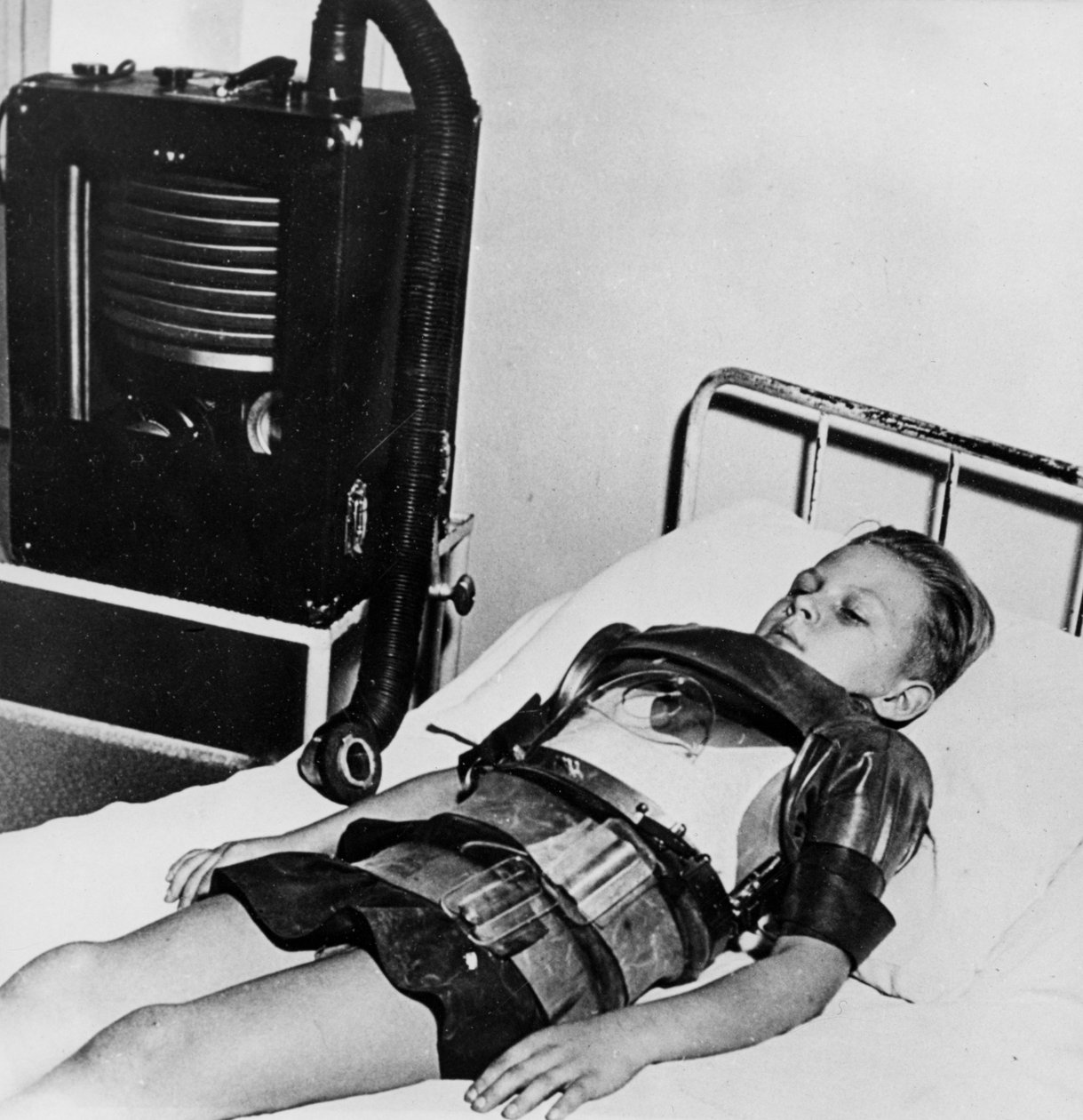 Menino de onze anos de idade em um pulmão de ferro, Hospital Beaujon, Paris, c1947-1951 de Unbekannt