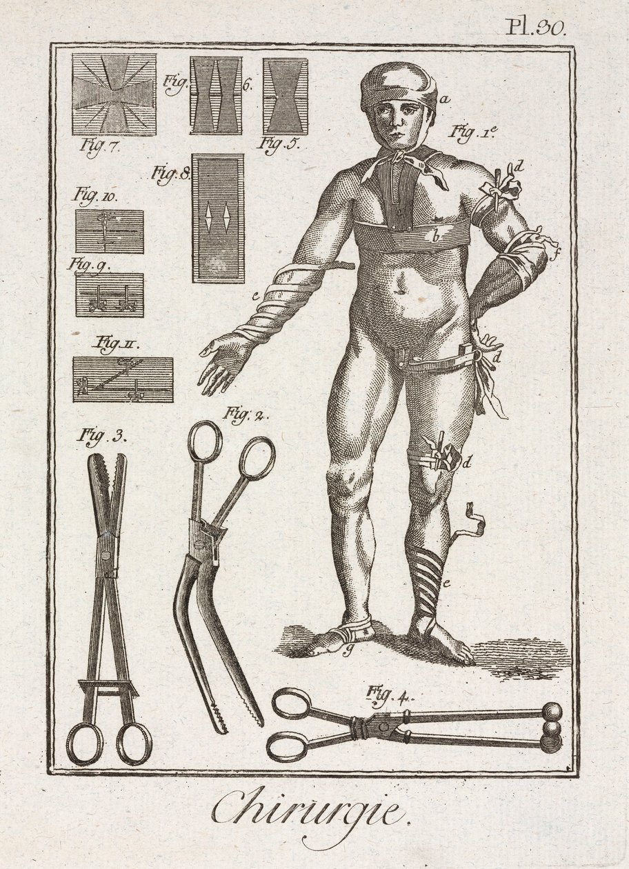 Equipamento, Bandagem Precoce-Moderna de uma figura humana de Unbekannt