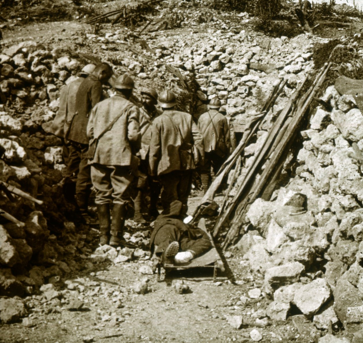 Ferido alemão, c1914-c1918 de Unbekannt