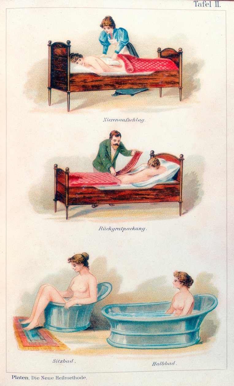 Tratamentos de hidroterapia, c1902 de Unbekannt