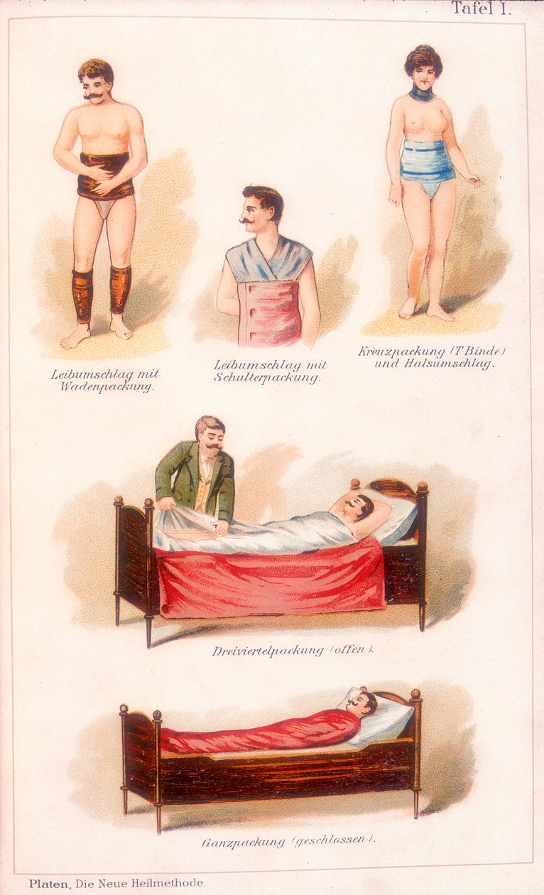 Tratamentos de hidroterapia, c1902 de Unbekannt