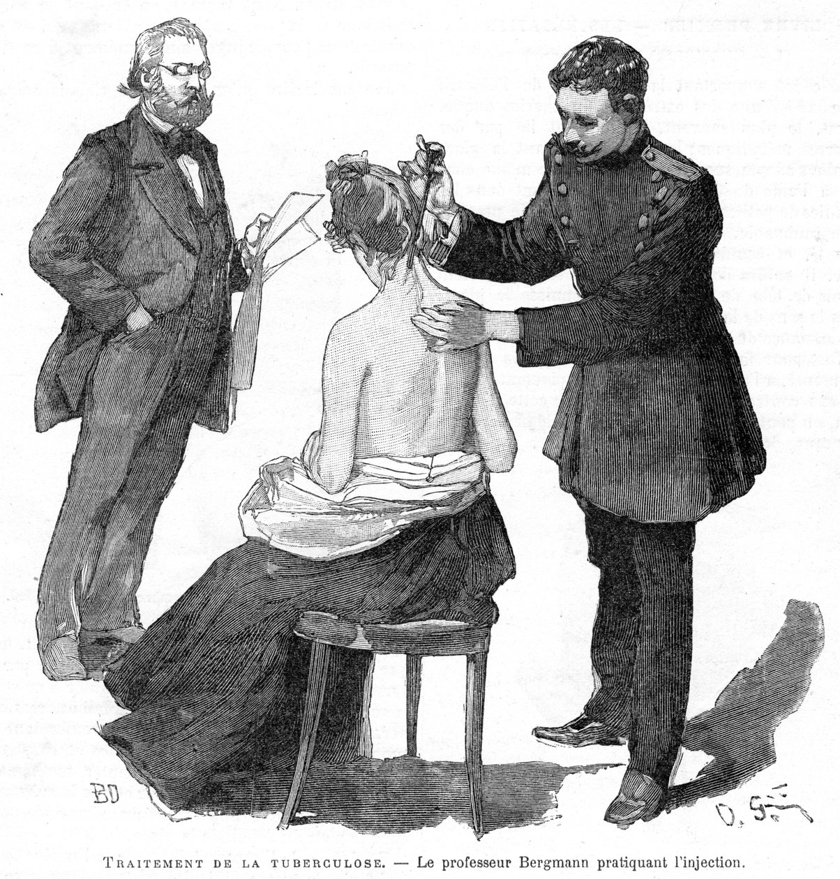 Professor Bergmann injetando um paciente de tuberculose, 1891 de Unbekannt