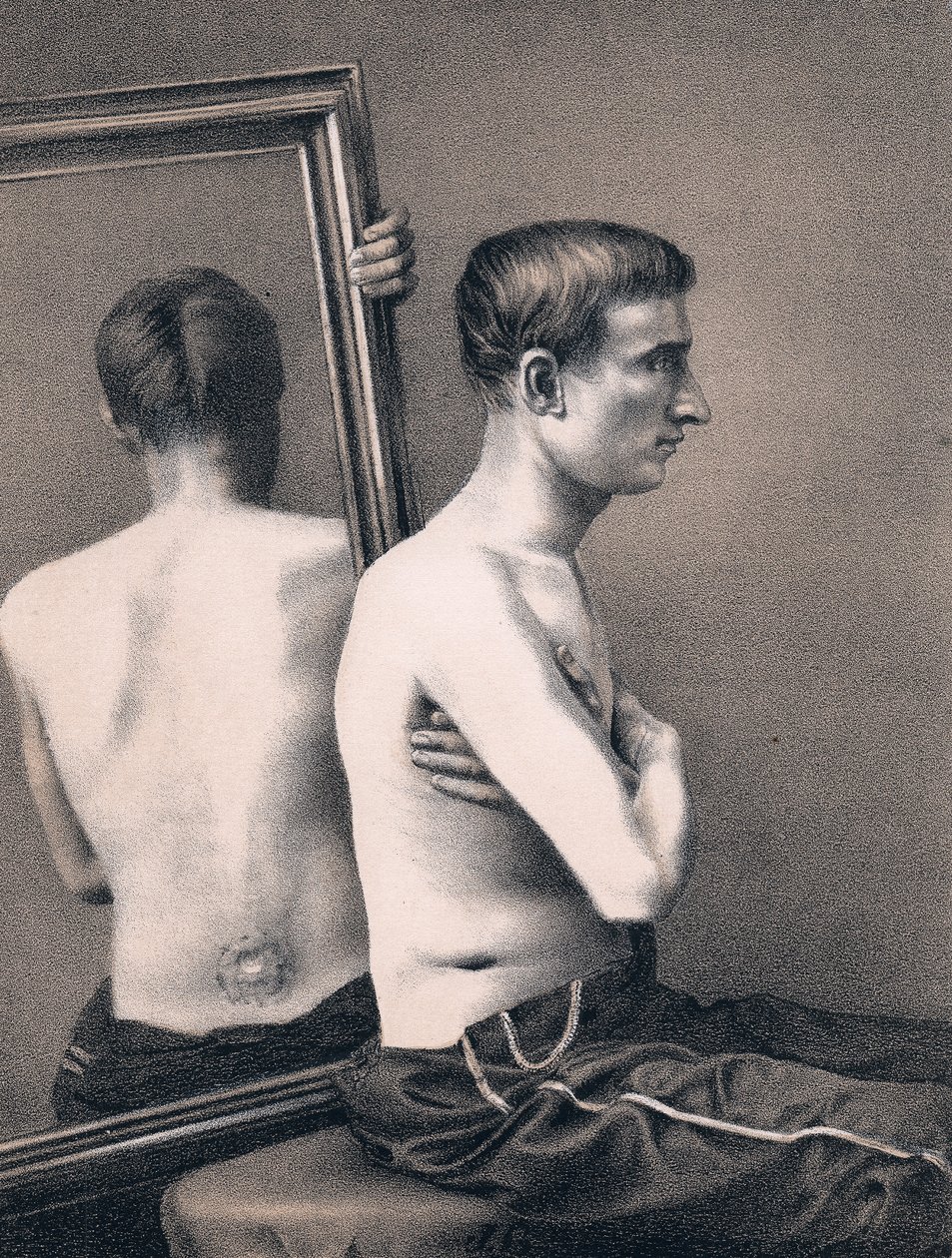 Recuperando a vítima de um ferimento de bala no abdômen, Guerra Civil Americana, 1865 de Unbekannt