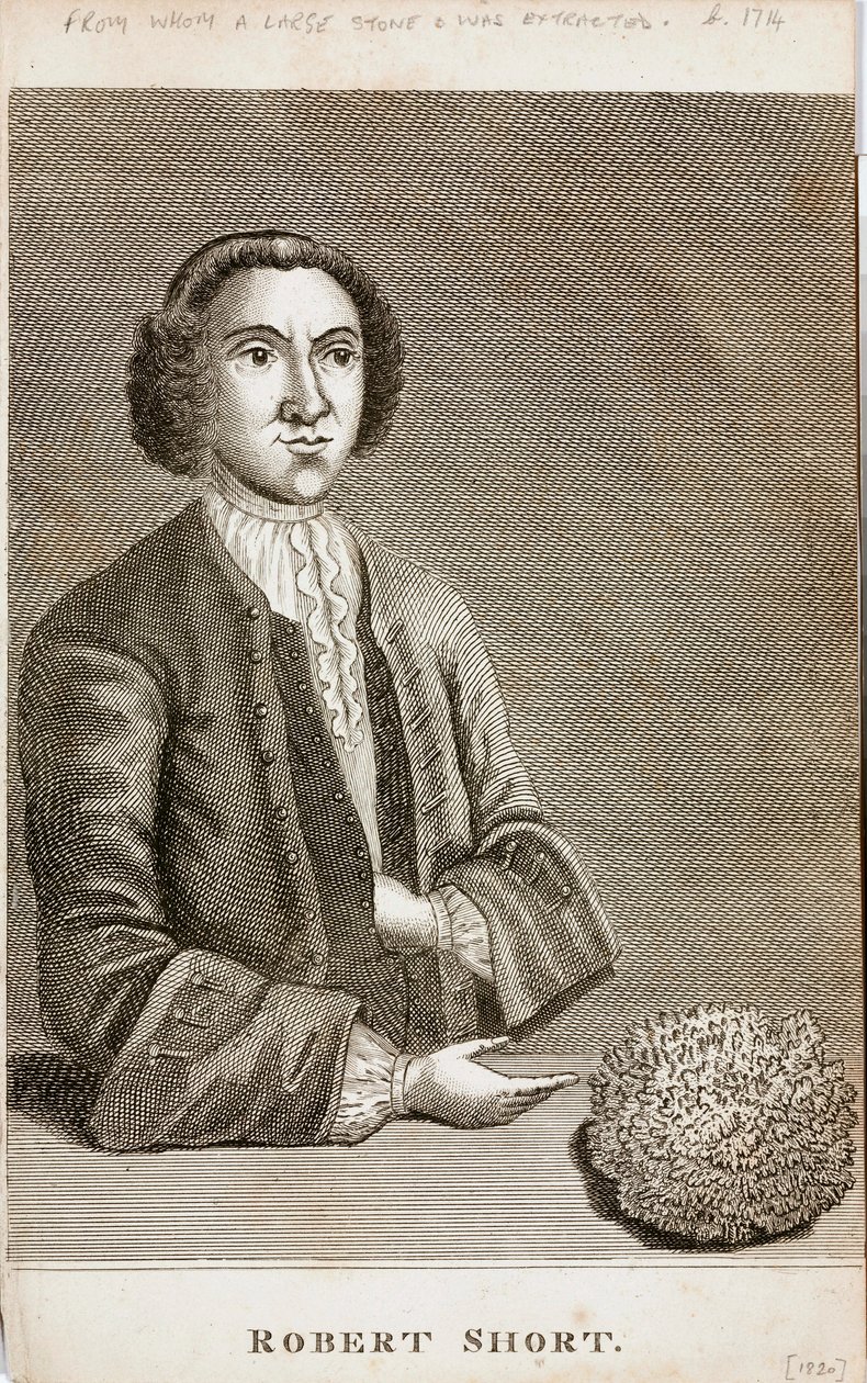 Robert Short, curiosidade médica, c 1750s de Unbekannt