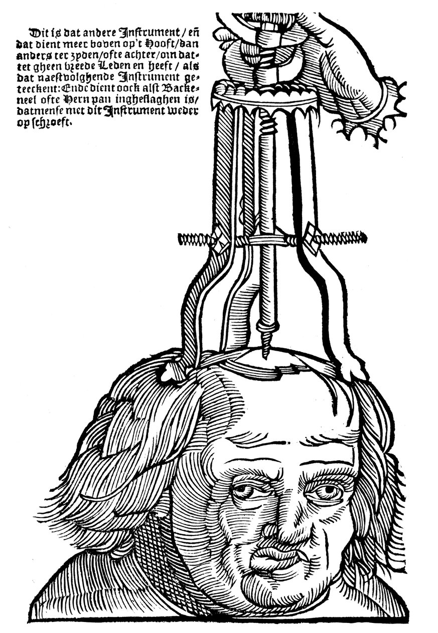 Trefinação, 1593 de Unbekannt