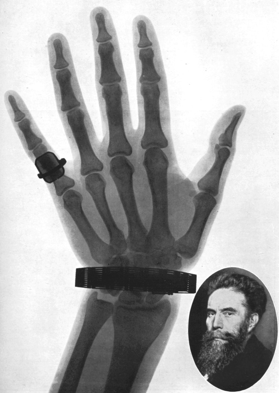 Fotografia de raio X de uma mão, 1926 de Unbekannt