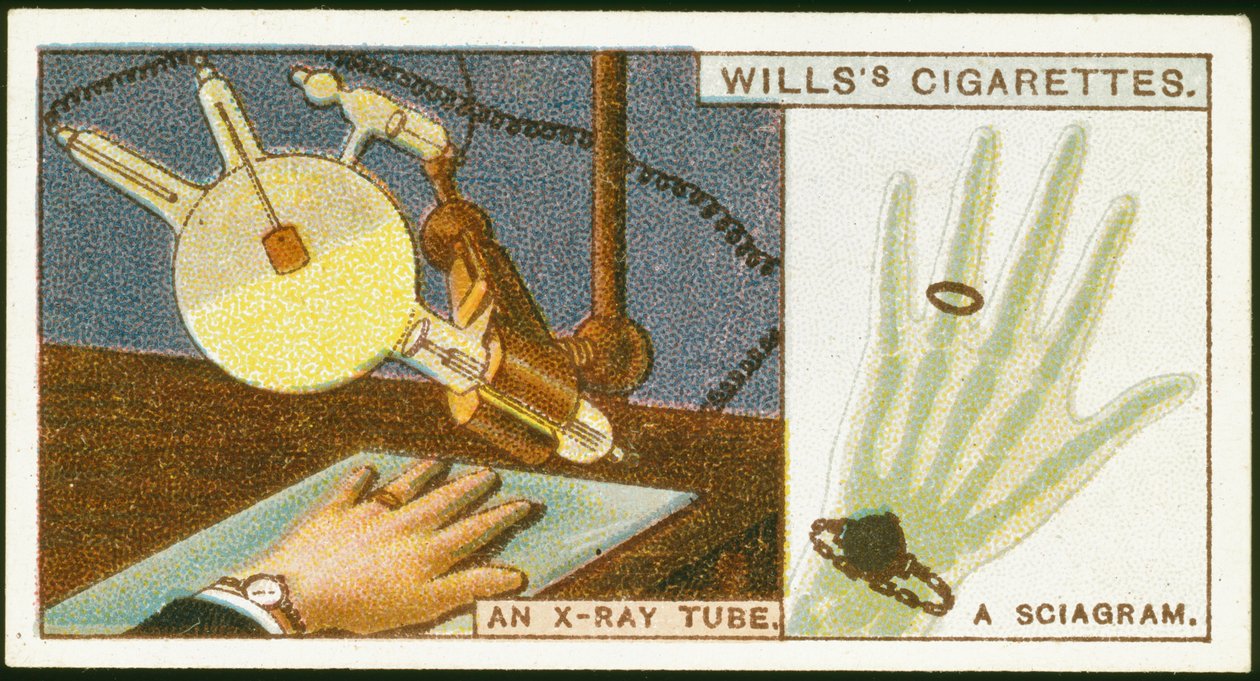 Radiografando a mão, 1924 de Unbekannt