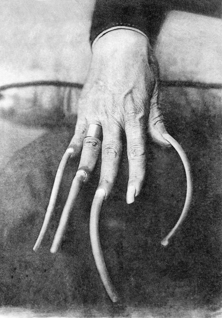 Particularidade monstruosa: uma mão com unhas muito compridas. China 1910 about Fotografia histórica, unhas compridas, China, ca. 1910 de Unbekannter Künstler