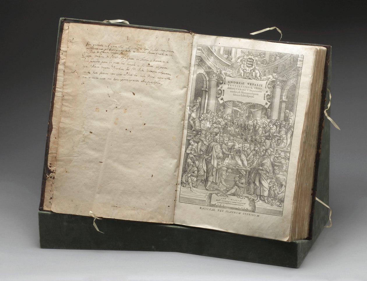 Patologia, Dissecação Corte de madeira de Andreas Vesalius dissecando um cadáver de Unbekannt