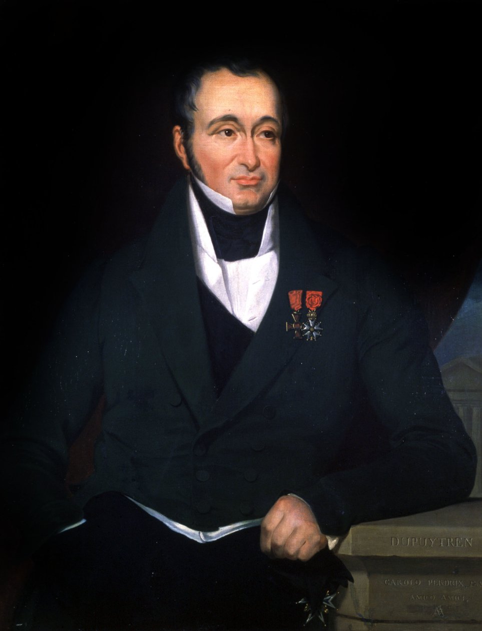O médico Dupuytren, c.1820 (pintura) de Unbekannter Künstler