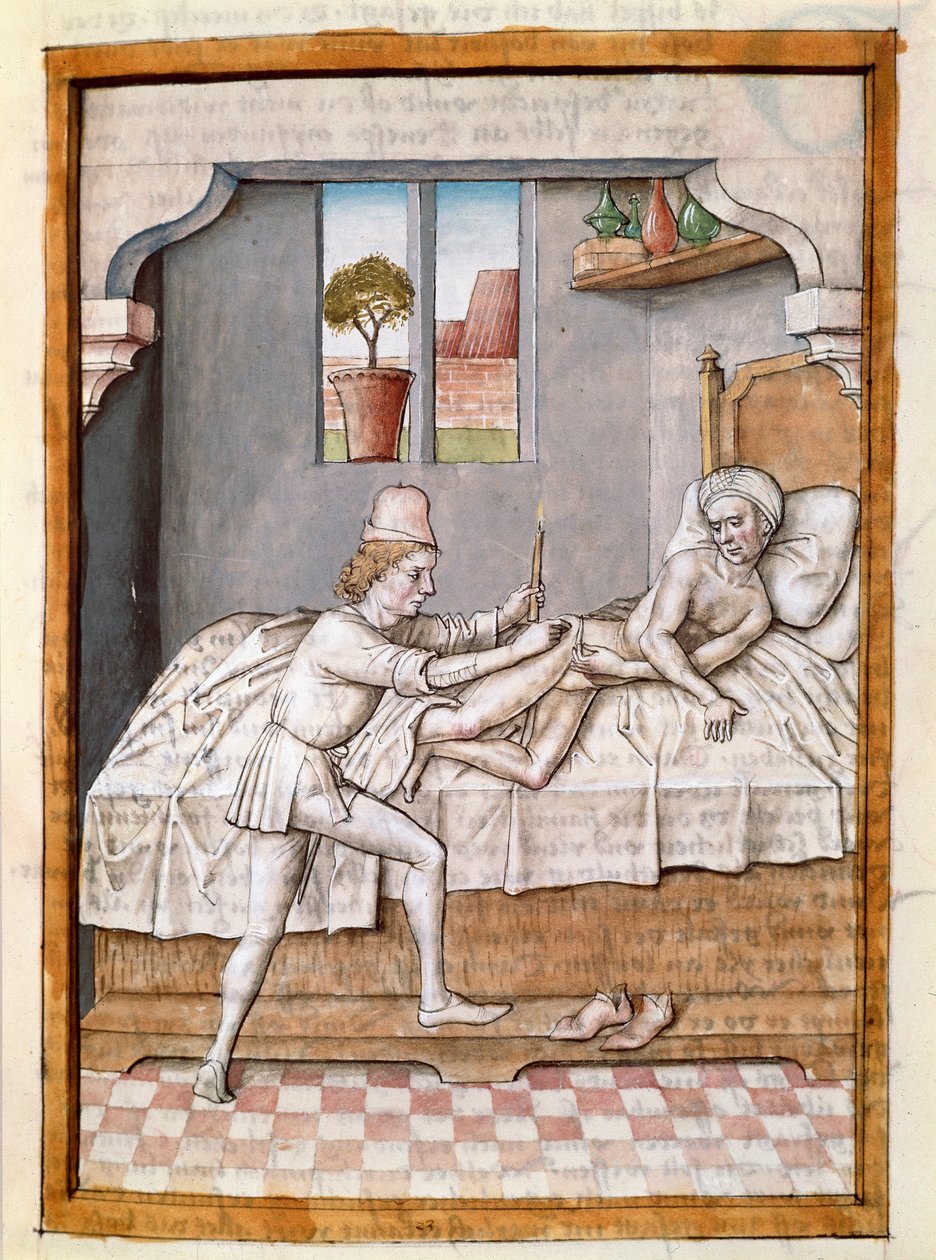 Um médico trata um paciente miniatura de uma tradução alemã das fábulas de "Kalila (Calila) e Dimna" de Bidpai. (ms. 1389, fol. 23) por volta de 1480 Chantilly, museu Conde de Unknown artist
