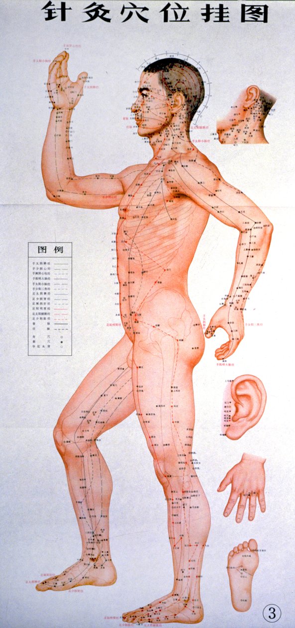 Acupunctura de Unknown Artist