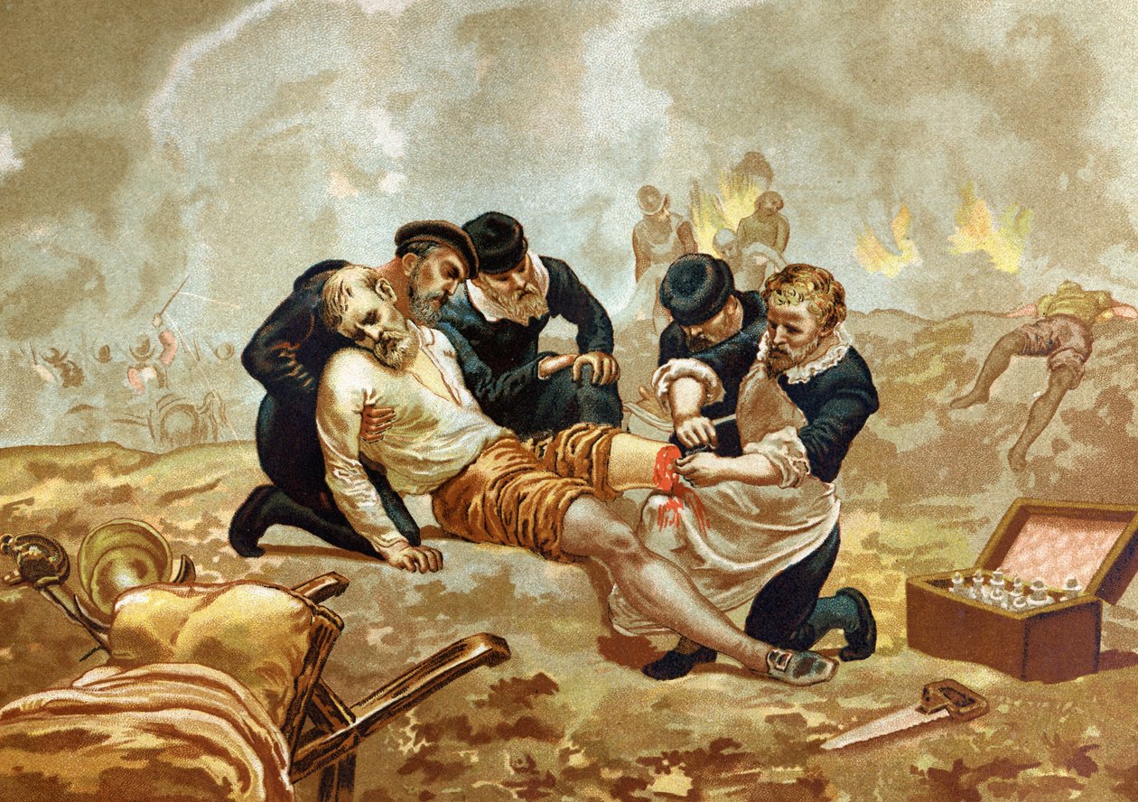 Ambroise Pare Medicin e cirurgião francês (c. 1509-1590) pratica ligadura de arteres após amputação. de após hombres y Mujeres celebres. Barcelona 1877. de Unknown artist