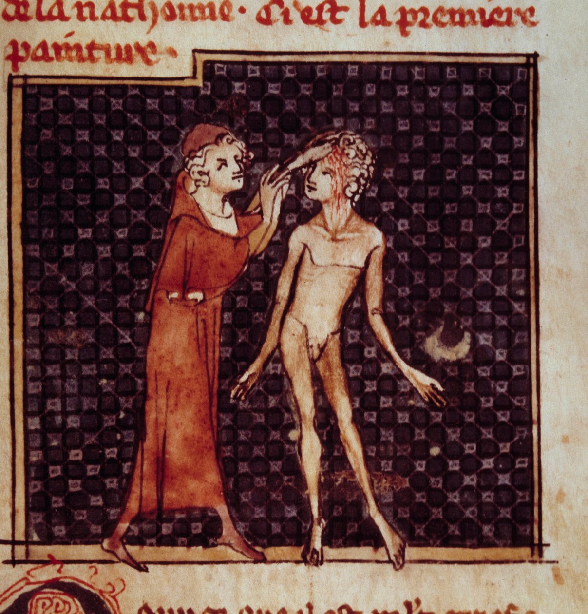 Figura anatómica: O cirurgião incide na testa de um paciente. Miniatura do manuscrito "Cirurgia" (Folio 8) escrito por Henri de Mondeville (cirurgião de Philippe Le Bel professor de anatomia) de Unknown artist