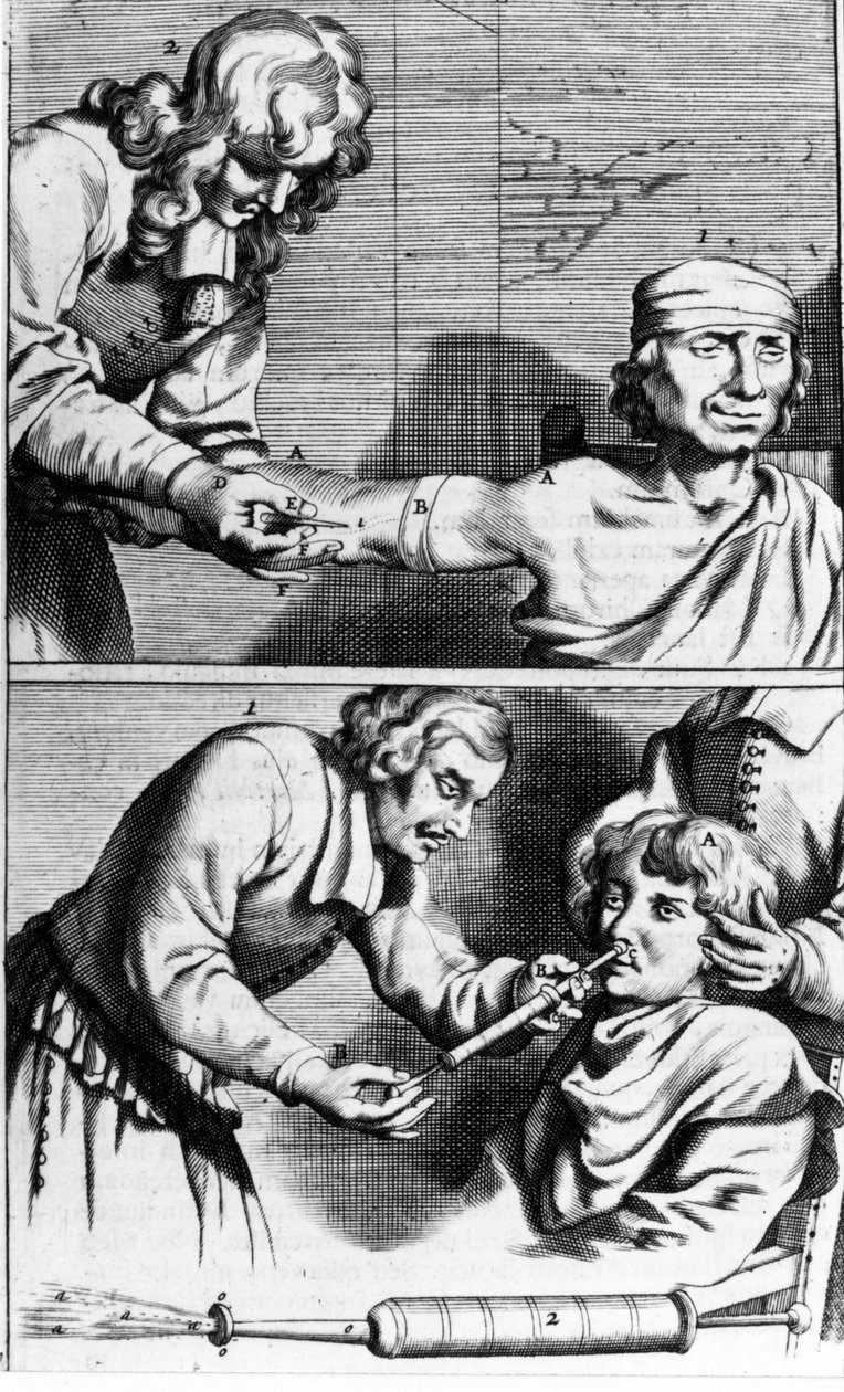 Sangramento e duche nasal por Johannes Sculpteti "Armamentarium Surgery" Amsterdão 1672 de Unknown artist