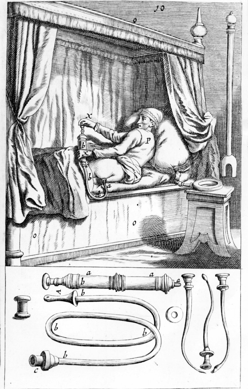 Clystère (para enemas) por Johannes Sculptetus "Armamentarium Surgical". Veneza 1665 de Unknown artist