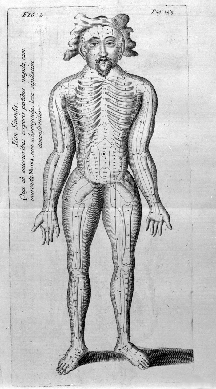 De Acupunctura, de W.Ten Rhijne. Londres, 1683. Primeiro texto ocidental que trata da Acupuntura. de Unknown artist