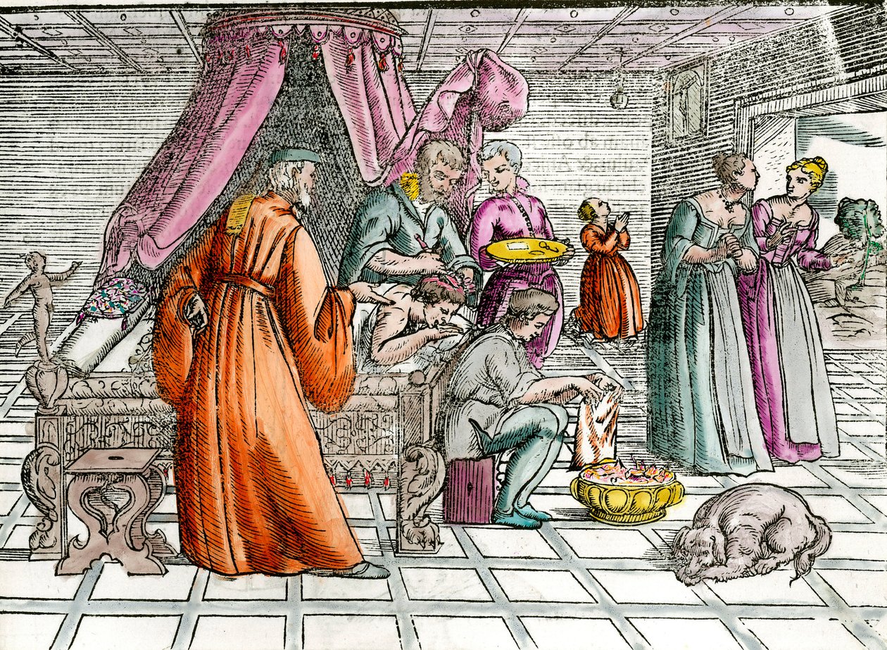 Doutor: "Uma trepanação" Um cirurgião opera o crânio do seu paciente. Gravura da Coleção Privada do século XVI de Unknown artist