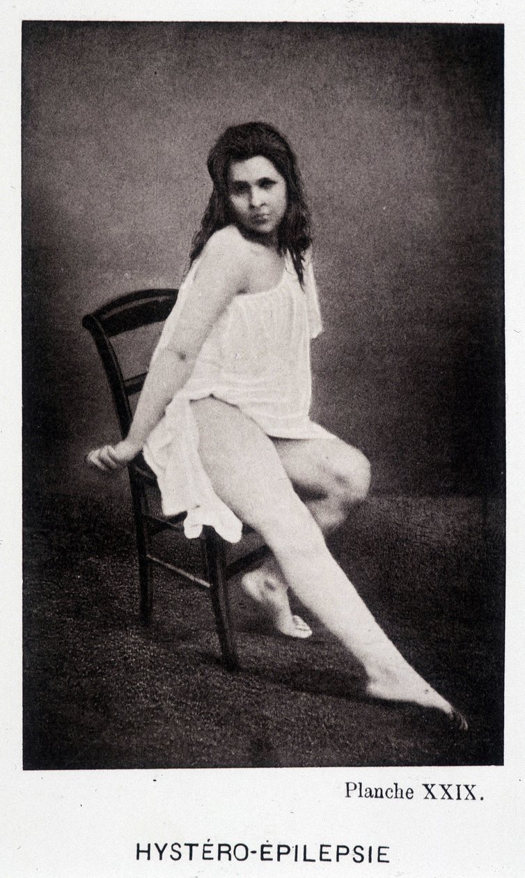 Hystero Epilepsie - Contractura em "Iconografia fotográfica da Salpétrière: serviço de Mr. Charcot" de Paul Regnard e Bourneville de Unknown artist