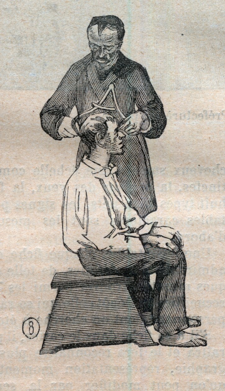Antropometria forense ou bertillonnage, método de Alphonse Bertillon (1853-1914): medição do diâmetro transversal do crânio - Gravura em "La Science francaise de Unknown artist