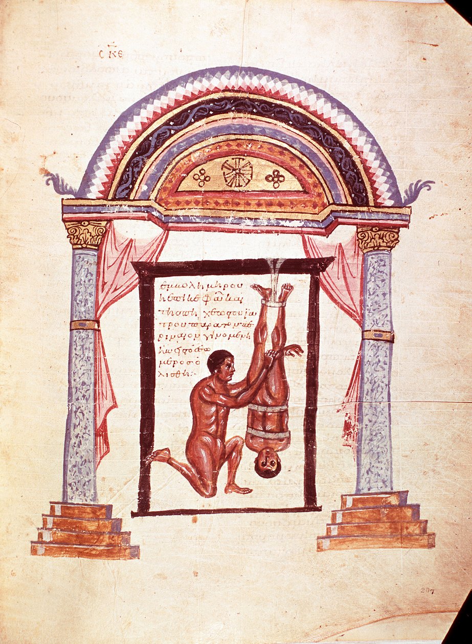 Medicina: redução de um joelho deslocado, o paciente é suspenso pelos pés (manuscrito de Unknown artist