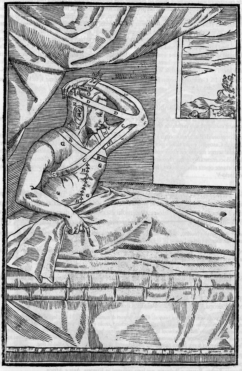 Cirurgia no nariz: Cirurgia reconstrutiva no nariz em "De curtorum chirurgia per insitionem". Veneza de Unknown artist