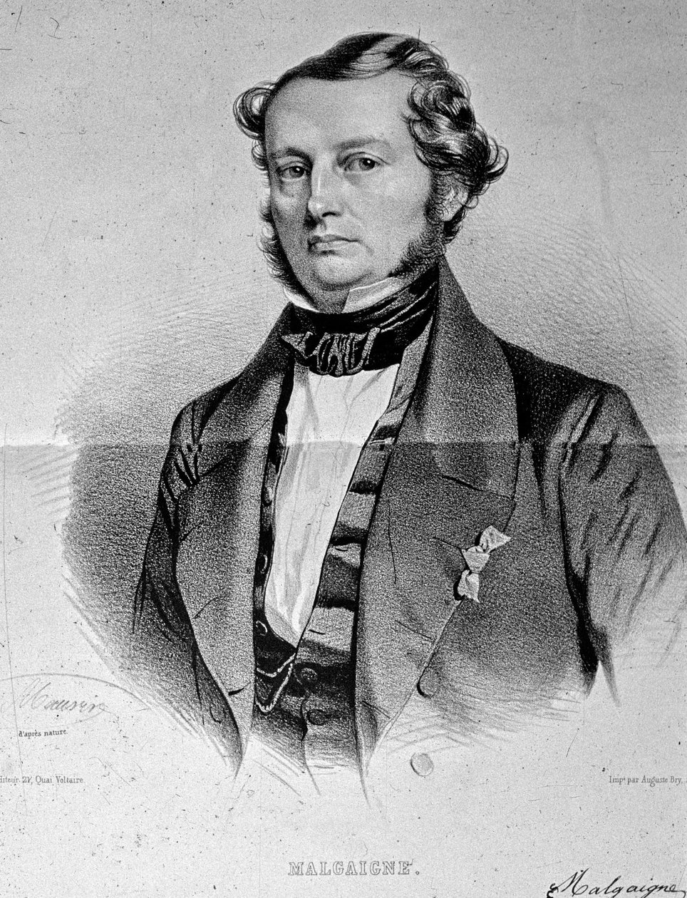 Retrato de Joseph François Malgaigne (1806-1865) de Unknown artist