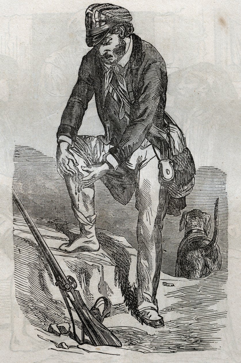 Raiva - tratamento de mordidas feitas por um animal enfurecido - dói pressionando sua ferida - gravura em "La Sante Universelle - Guia Médico para Famílias" 1852 de Unknown artist