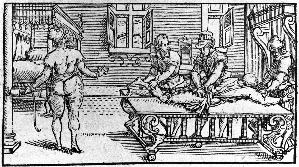 Redução de um deslocamento, - no "Traité Médical" de Ambroise Paré, cerca de 1560. de Unknown artist