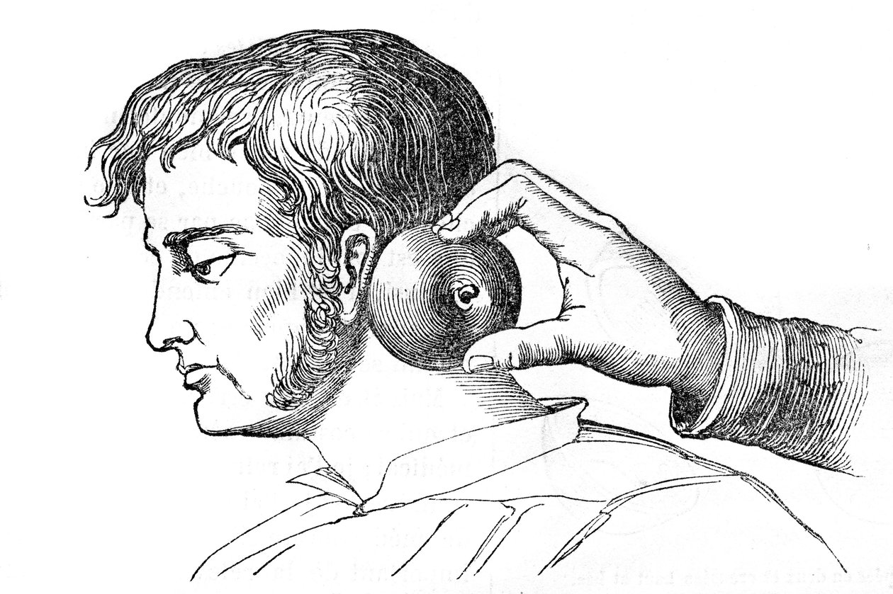 Saignee locales - aplicação de sanguessugas com maçã - gravura em "La Santo Universelle - Guia Médico para as Famílias" 1852 de Unknown artist