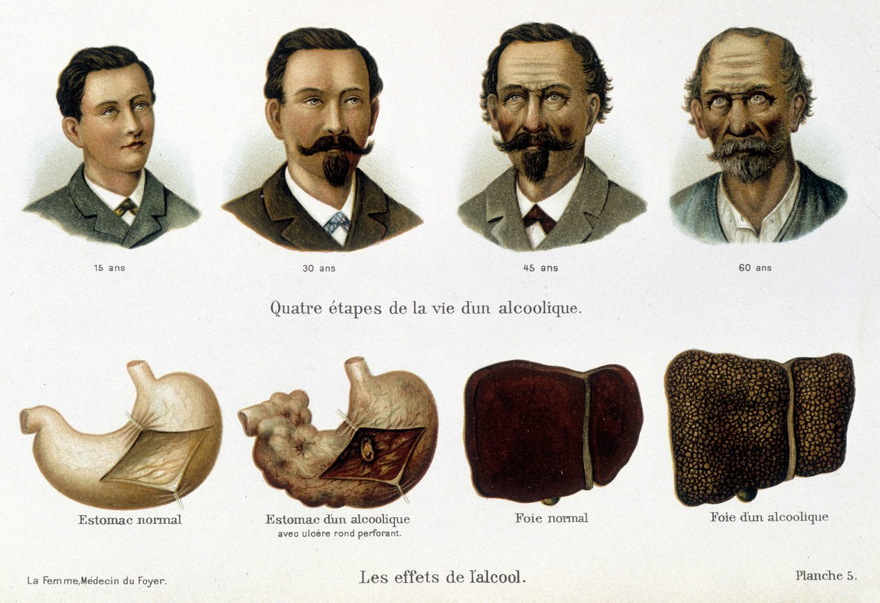 Os efeitos do álcool: as quatro fases da vida de um alcoólico representadas pelo seu rosto e fígado. - em "a mulher, médica doméstica". de Unknown artist