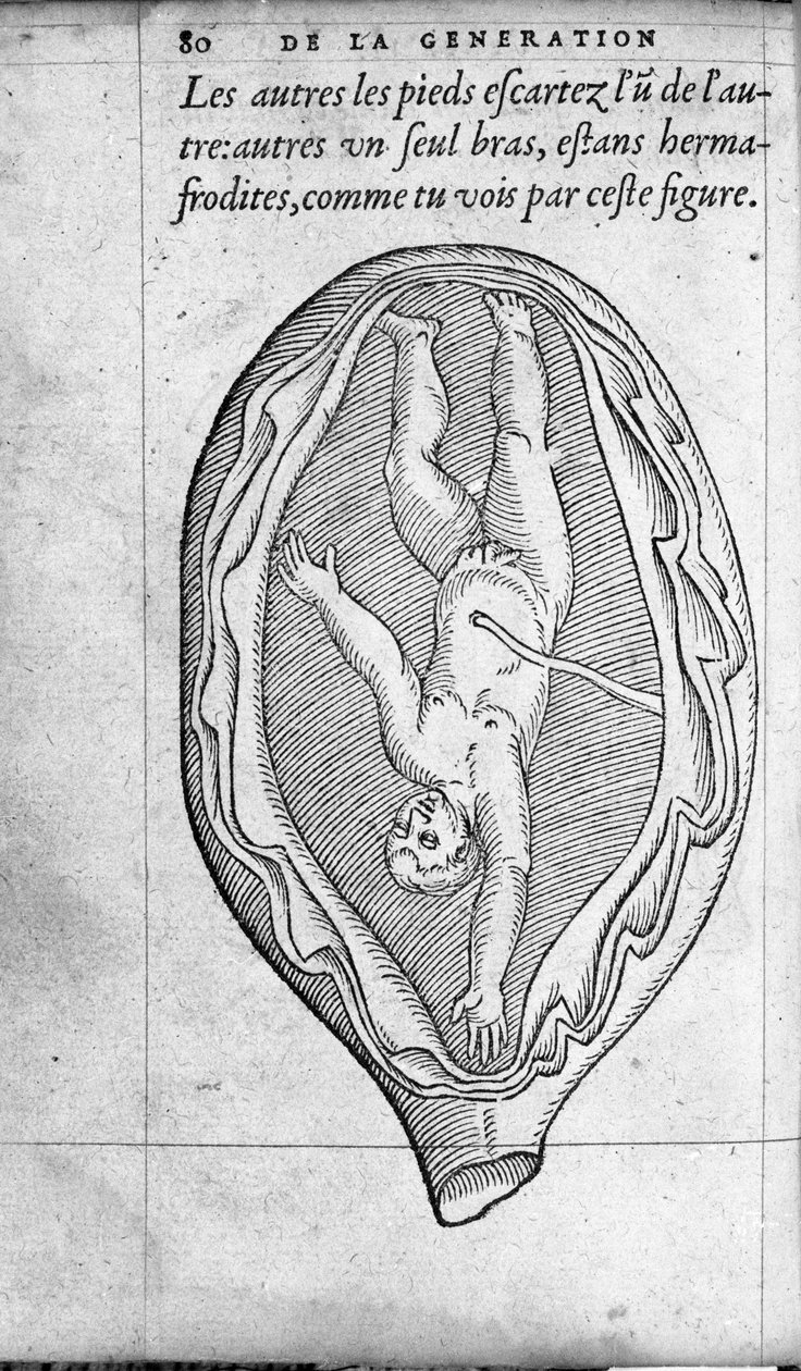 A posição do feto no útero durante a gravidez. Gravura da "De la generation des enfants" do médico e cirurgião francês Ambroise Pare (1509-1590) Século XVI de Unknown artist