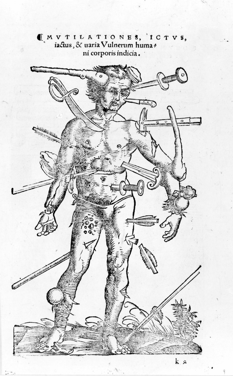 Todo o tipo de ferimentos de guerra traumáticos. Século XVI de Unknown artist