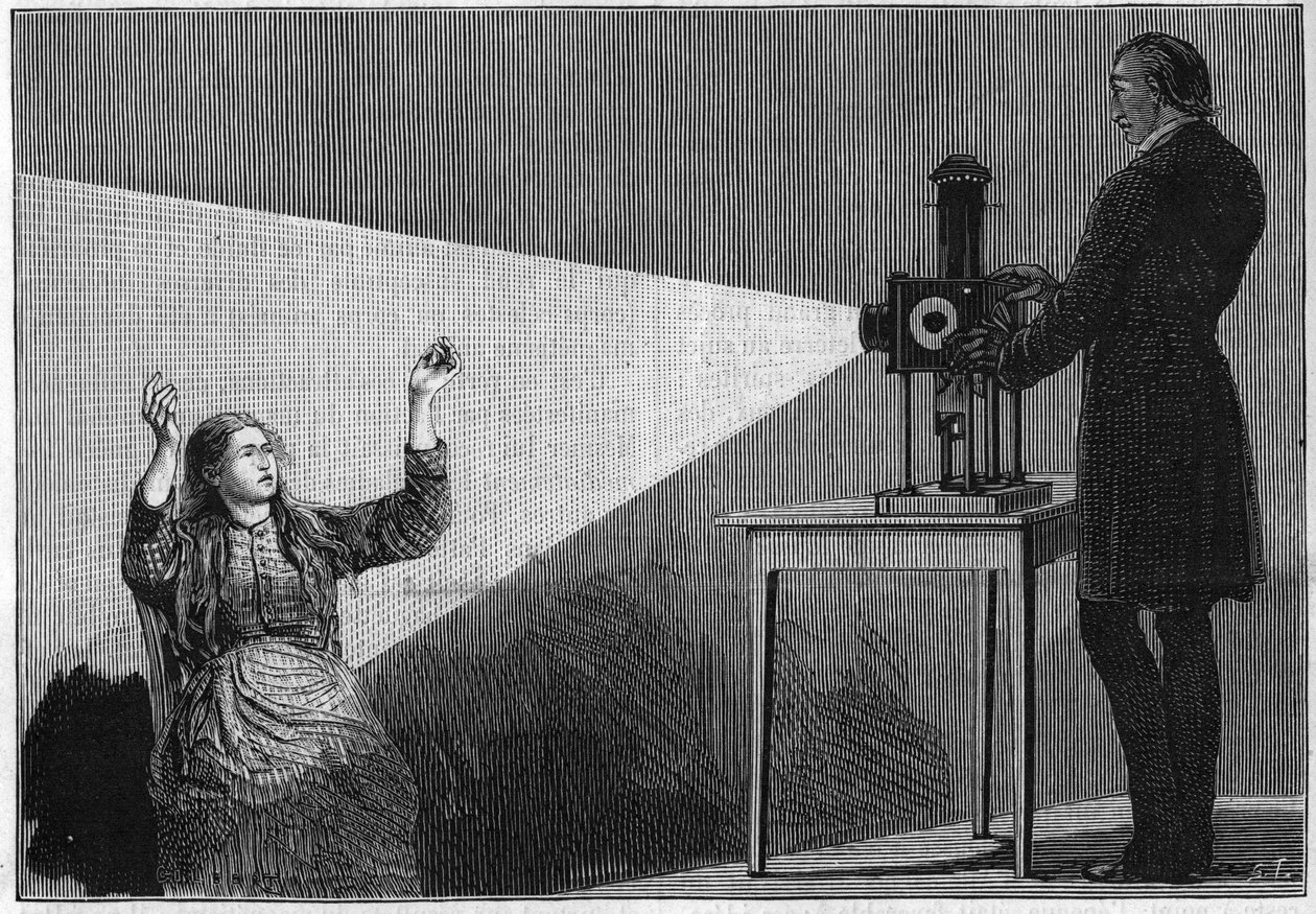Catalepsy produzida sob a influência da luz. O neurologista francês Jean Martin Charcot (1825-1893) estudando o fenômeno da hipnose em um paciente do hospital de Salpetriere. de Unknown artist