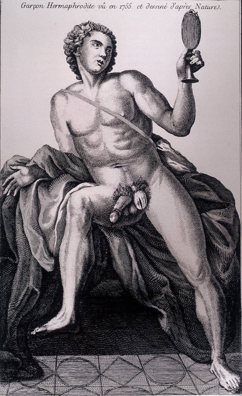 Rapaz hermafrodita visto em 1755 e extraído da natureza. de Unknown artist