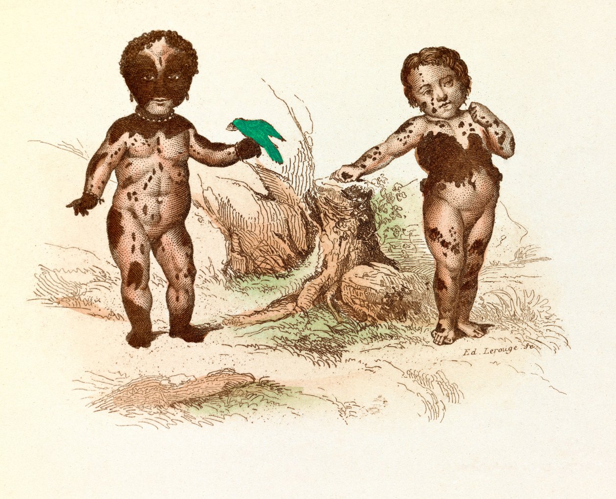 Menina coberta de manchas peludas (gravura) de Unknown artist