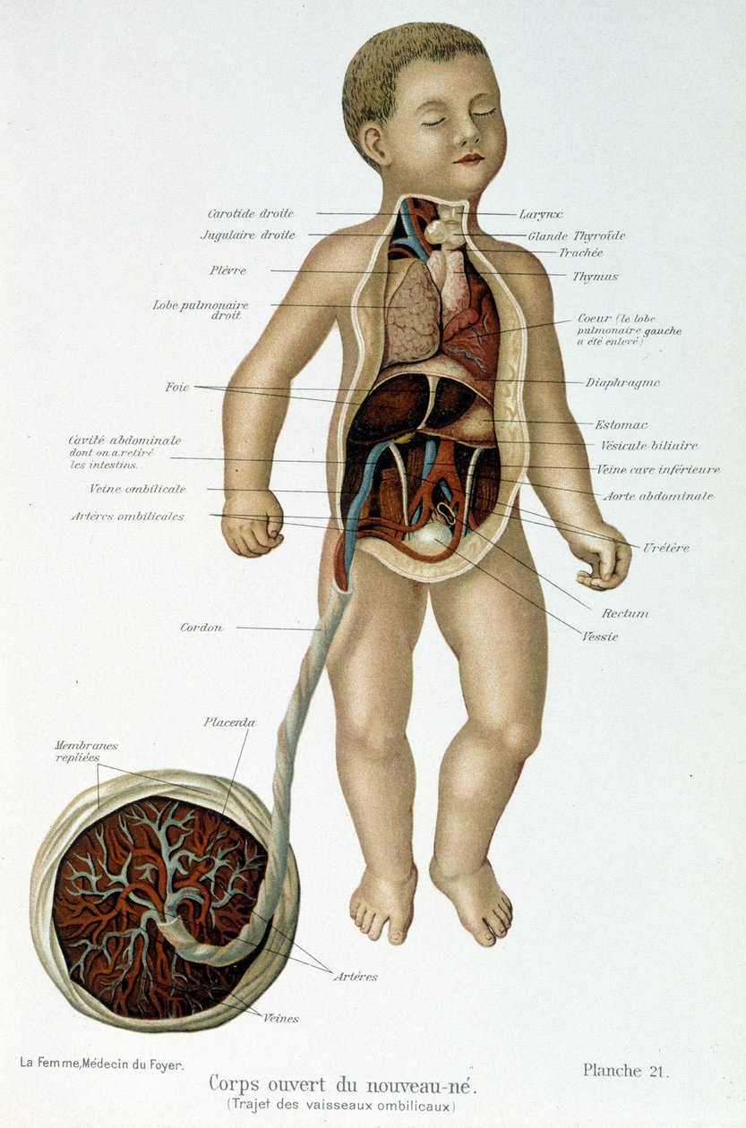 Medicina: recém-nascido (esfolado no busto). de Unknown artist