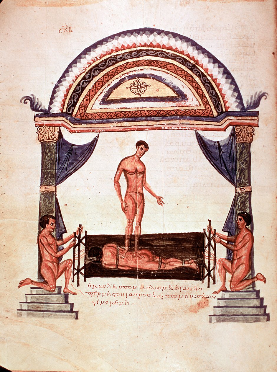 Medicina: redução da coluna deslocada - o paciente é fixado em uma tábua de madeira, um dos terapeutas fica em pé nas costas (manuscrito de Unknown artist