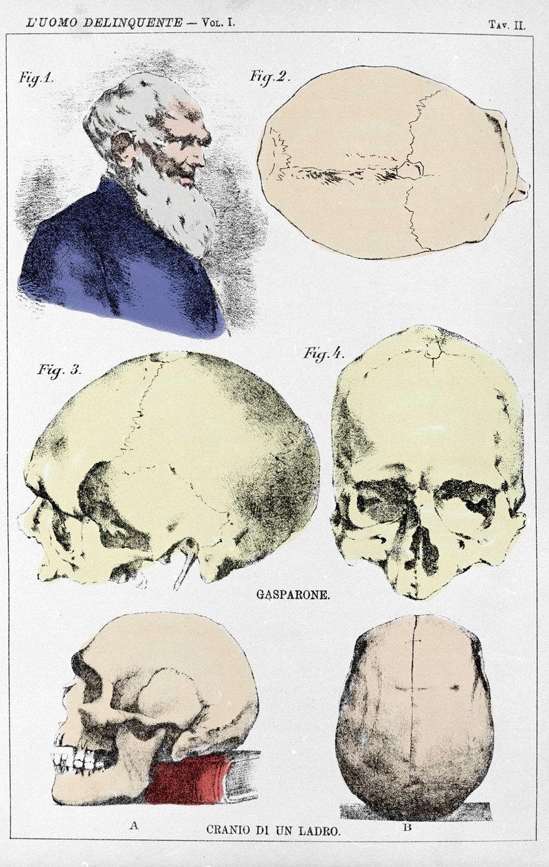 Estudo sobre a morfologia de um crânio delinquente pelo criminologista italiano de Unknown artist