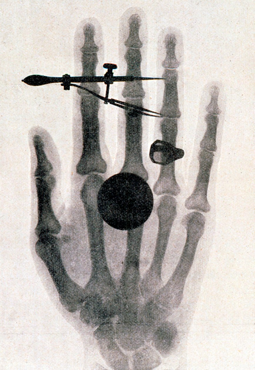 Fotografia da mão da esposa de Wilhelm Roentgen com raios X, 1896 de Wilhelm Conrad Rontgen