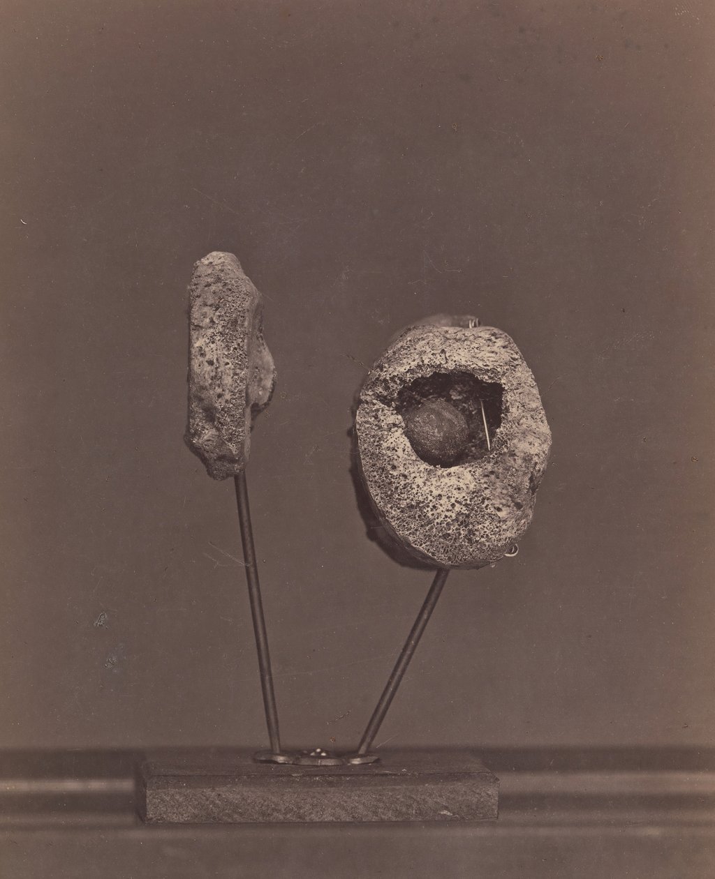 Joelheira Excised Knee Joint. Uma bola de mosquete redonda no côndilo interno do fémur direito [Gardin..., 1866-67]. de William H. Bell